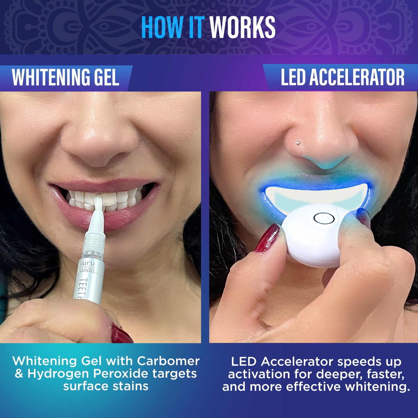 Gurunanda Professional Teeth Whitening Wireless Kit